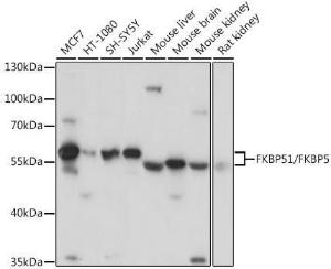 Western blot analysis of extracts of various cell lines, using Anti-FKBP51 Antibody (A9309) at 1:3,000 dilution The secondary antibody was Goat Anti-Rabbit IgG H&L Antibody (HRP) at 1:10,000 dilution Lysates/proteins were present at 25 µg per lane