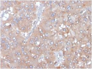 Immunohistochemical analysis of formalin-fixed, paraffin-embedded human adrenal gland tissue using Anti-IL-5 Antibody [IL5/4161]