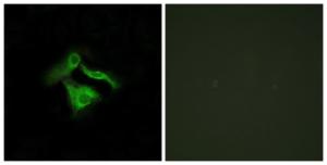 Antibody anti-GPR149 A99565-100 100 µg