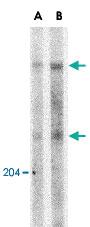 Anti-ATM Rabbit Polyclonal Antibody