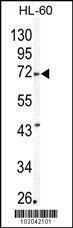 Anti-MMP24 Rabbit Polyclonal Antibody (HRP (Horseradish Peroxidase))