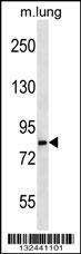 Anti-LRSAM1 Rabbit Polyclonal Antibody (AP (Alkaline Phosphatase))