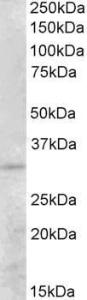 Anti-PEX26 Antibody (A83577) (05 µg/ml) staining of Human Kidney lysate (35 µg protein in RIPA buffer) Primary incubation was 1 hour Detected by chemiluminescence