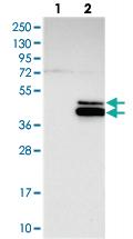 Anti-RPUSD4 Rabbit Polyclonal Antibody