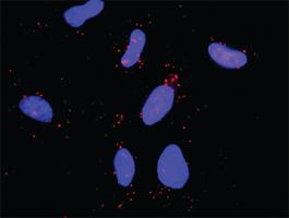 Anti-CBL + PLCG1 Antibody Pair