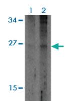 Anti-TNFRSF12A Rabbit Polyclonal Antibody