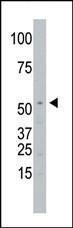 Anti-SPPL2A Rabbit Polyclonal Antibody (PE (Phycoerythrin))