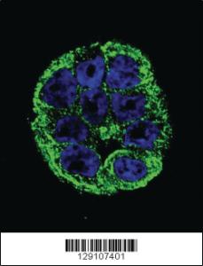 Anti-YOD1 Rabbit Polyclonal Antibody [clone: 169CT7.1.3]