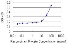 Anti-SCP2D1 Mouse Monoclonal Antibody [clone: 3C11]