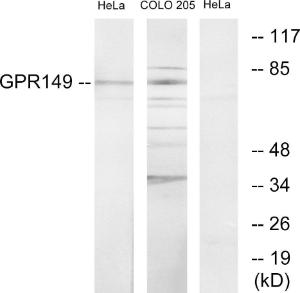 Antibody anti-GPR149 A99565-100 100 µg