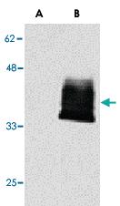 Anti-TNFRSF12A Rabbit Polyclonal Antibody