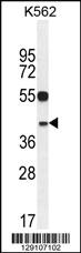 Anti-YOD1 Rabbit Polyclonal Antibody [clone: 169CT7.1.3]