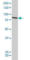 Anti-QARS Mouse Monoclonal Antibody [clone: 5F5]