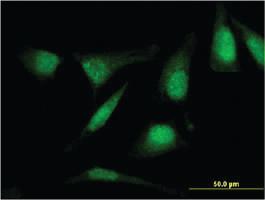 Anti-RASSF4 Mouse Monoclonal Antibody [clone: 1D5]