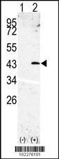 Anti-SPPL3 Rabbit Polyclonal Antibody (APC (Allophycocyanin))