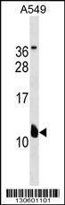 Anti-KCNE2 Rabbit Polyclonal Antibody (FITC (Fluorescein Isothiocyanate))