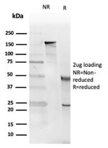 SDS-PAGE analysis of Anti-IL-5 Antibody [IL5/4161] under non-reduced and reduced conditions; showing intact IgG and intact heavy and light chains, respectively. SDS-PAGE analysis confirms the integrity and purity of the antibody.