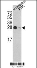 Anti-POTEKP Rabbit Polyclonal Antibody