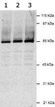 Anti-Kaposi's sarcoma-associated herpesvirus LANA2 Mouse Monoclonal Antibody [clone: CM-A807]