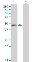 Anti-PHF7 Mouse Monoclonal Antibody [clone: 3F3]