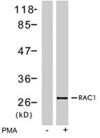 Anti-RAC1 Rabbit Polyclonal Antibody