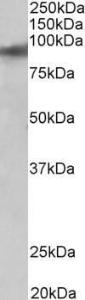 Anti-ZNF652 Antibody (A83581) (0.01 µg/ml) staining of Human Heart lysate (35 µg protein in RIPA buffer). Primary incubation was 1 hour. Detected by chemiluminescence