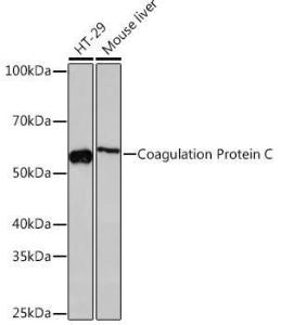 Western blot analysis of extracts of various cell lines, using Anti-Protein C Antibody [ARC1023] (A306260) at 1:1,000 dilution. The secondary antibody was Goat Anti-Rabbit IgG H&L Antibody (HRP) at 1:10,000 dilution.