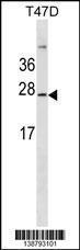 Anti-GKN3P Rabbit Polyclonal Antibody