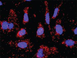 Anti-PIK3R1 + SRC Antibody Pair