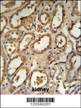 Anti-DCP2 Rabbit Polyclonal Antibody (FITC (Fluorescein Isothiocyanate))