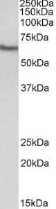 Anti-GGT1 Antibody (A83582) (0.3µg/ml) staining of Human Kidney lysate (35µg protein in RIPA buffer). Primary incubation was 1 hour. Detected by chemiluminescence.