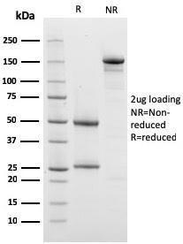 SDS-PAGE analysis of Anti-Prohibitin Antibody [PHB/3228] under non-reduced and reduced conditions; showing intact IgG and intact heavy and light chains, respectively SDS-PAGE analysis confirms the integrity and purity of the antibody