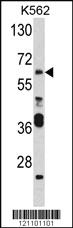 Anti-PAX3 Rabbit Polyclonal Antibody