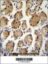 Anti-CC85C Rabbit Polyclonal Antibody