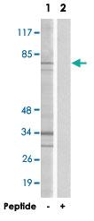 Anti-DDX51 Rabbit Polyclonal Antibody