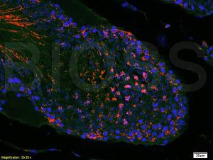 Anti-MTOR Rabbit Polyclonal Antibody