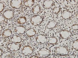 Anti-QARS Mouse Monoclonal Antibody [clone: 5F5]