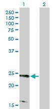 Anti-RRAS2 Rabbit Polyclonal Antibody