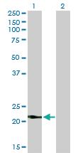 Anti-VSNL1 Mouse Monoclonal Antibody [clone: 2F1-E3]