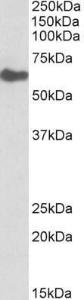 Anti-GGT1 Antibody (A83583) (0.1µg/ml) staining of Human Kidney lysate (35µg protein in RIPA buffer). Primary incubation was 1 hour. Detected by chemiluminescence.