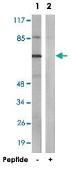 Anti-DQX1 Rabbit Polyclonal Antibody