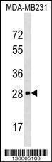 Anti-H1FOO Rabbit Polyclonal Antibody