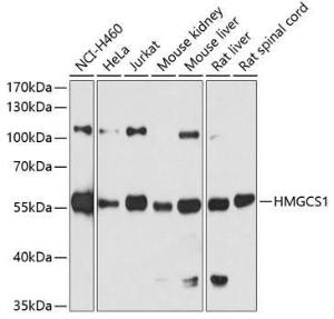 Western blot analysis of extracts of various cell lines, using Anti-HMGCS1 Antibody (A9326) at 1:7,000 dilution The secondary antibody was Goat Anti-Rabbit IgG H&L Antibody (HRP) at 1:10,000 dilution Lysates/proteins were present at 25 µg per lane