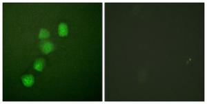 Immunofluorescence analysis of HUVEC cells using Anti-Cyclin E1 Antibody. The right hand panel represents a negative control, where the antibody was pre-incubated with the immunising peptide