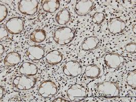 Anti-QARS Mouse Monoclonal Antibody [clone: 5F5]