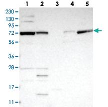 Anti-FBXO43 Rabbit Polyclonal Antibody