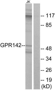 Western blot analysis of lysates from Jurkat cells using Anti-GPR142 Antibody The right hand lane represents a negative control, where the antibody is blocked by the immunising peptide