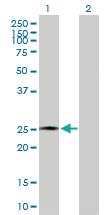 Anti-AMELX Rabbit Polyclonal Antibody