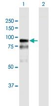 Anti-BAZ2B Mouse Polyclonal Antibody