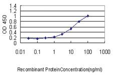 Anti-VSNL1 Mouse Monoclonal Antibody [clone: 2F1-E3]